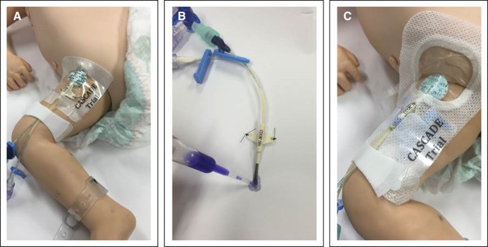 Skills module 3.0 central venous access devices pretest