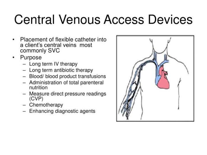 Skills module 3.0 central venous access devices pretest