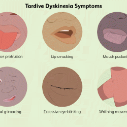 Tardive dyskinesia noun pathology